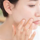 ニキビ